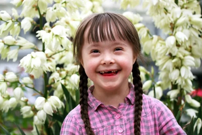 Hội chứng Down có mấy loại