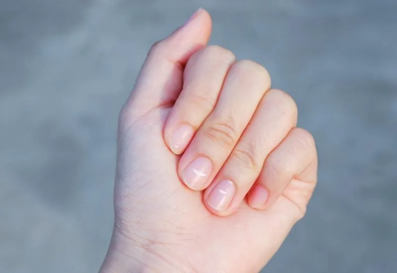 Các va đập cơ học nhỏ hàng ngày tại gốc móng có thể để lại vệt trắng sau vài tuần.